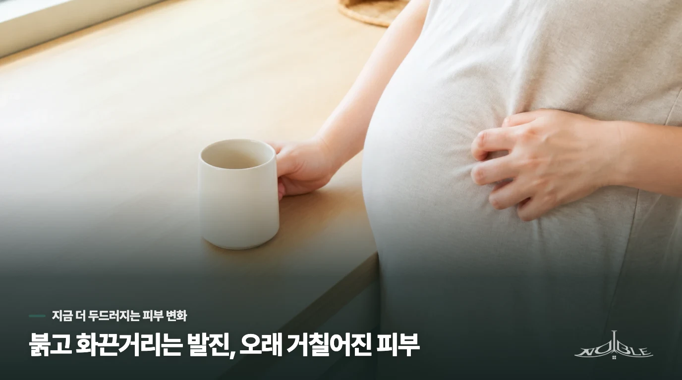붉고 화끈거리는 발진, 오래 거칠어진 피부