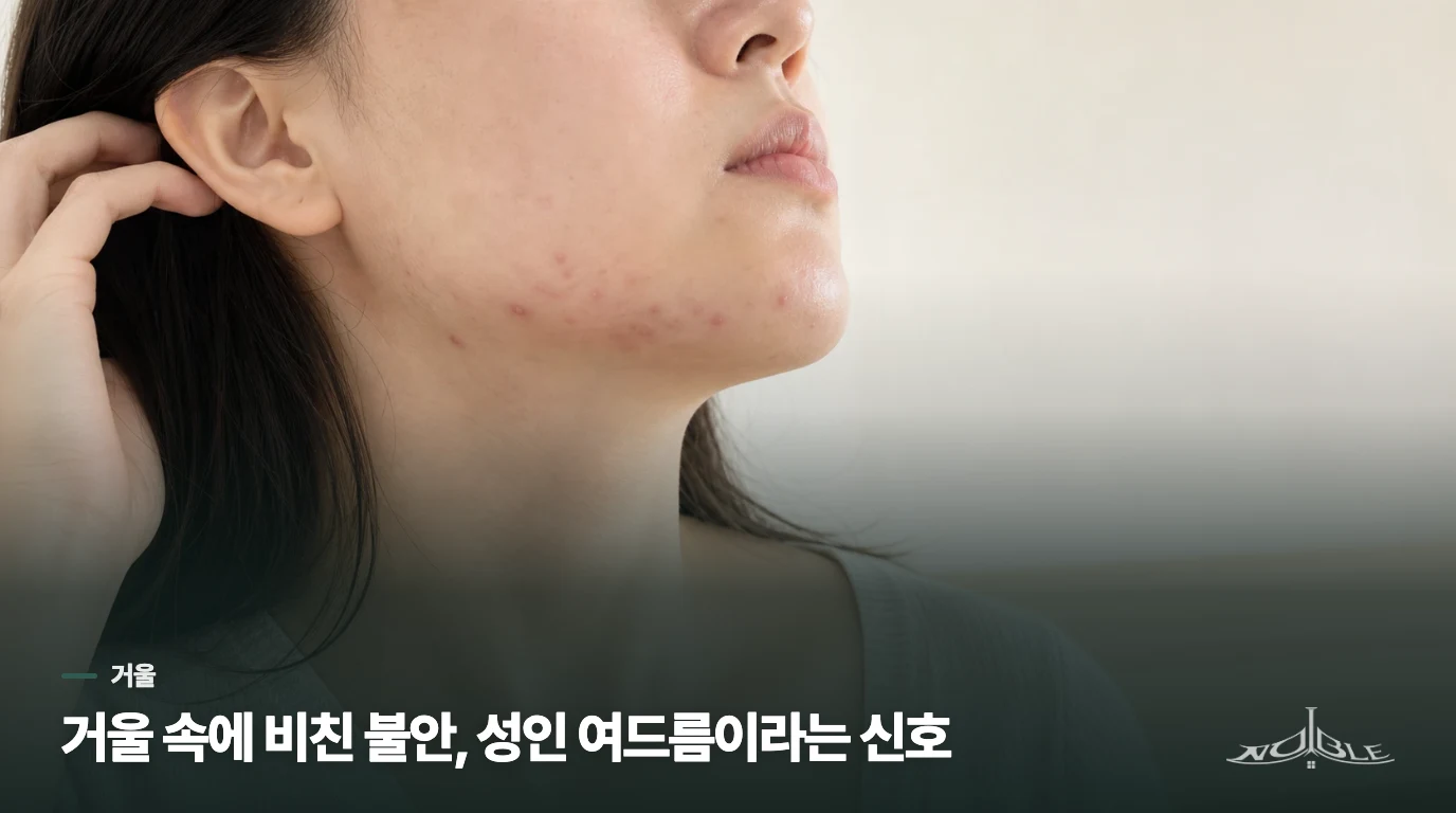 거울 속에 비친 불안, 성인 여드름이라는 신호