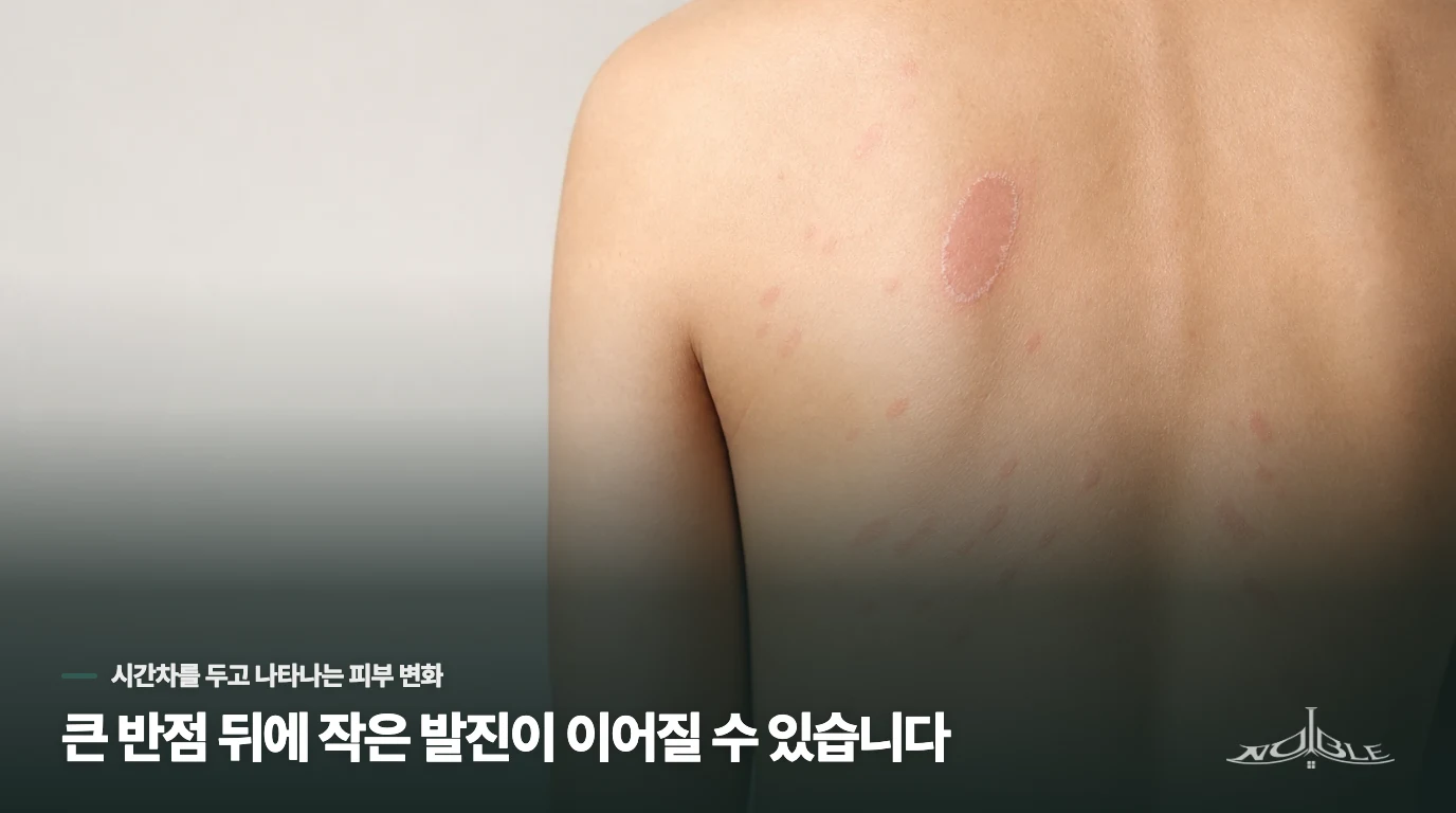 큰 반점 뒤에 작은 발진이 이어질 수 있습니다