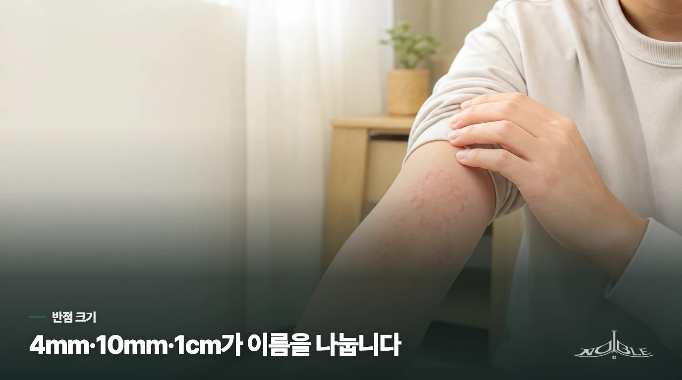 4mm 미만, 4~10mm, 1cm 초과는 서로 다른 이름입니다