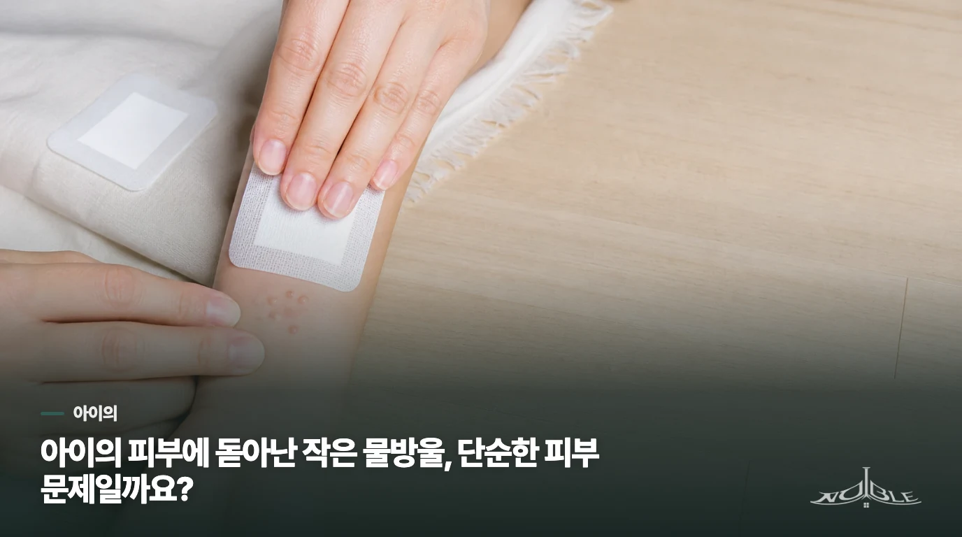 아이의 피부에 돋아난 작은 물방울, 단순한 피부 문제일까요?