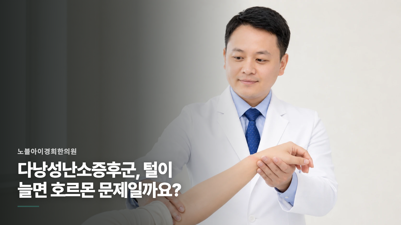 다낭성난소증후군, 털이 늘면 호르몬 문제일까요?