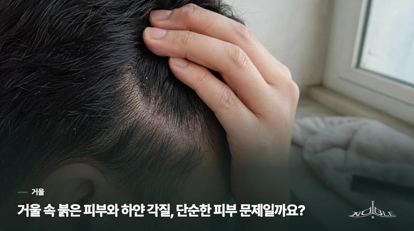 거울 속 붉은 피부와 하얀 각질, 단순한 피부 문제일까요?