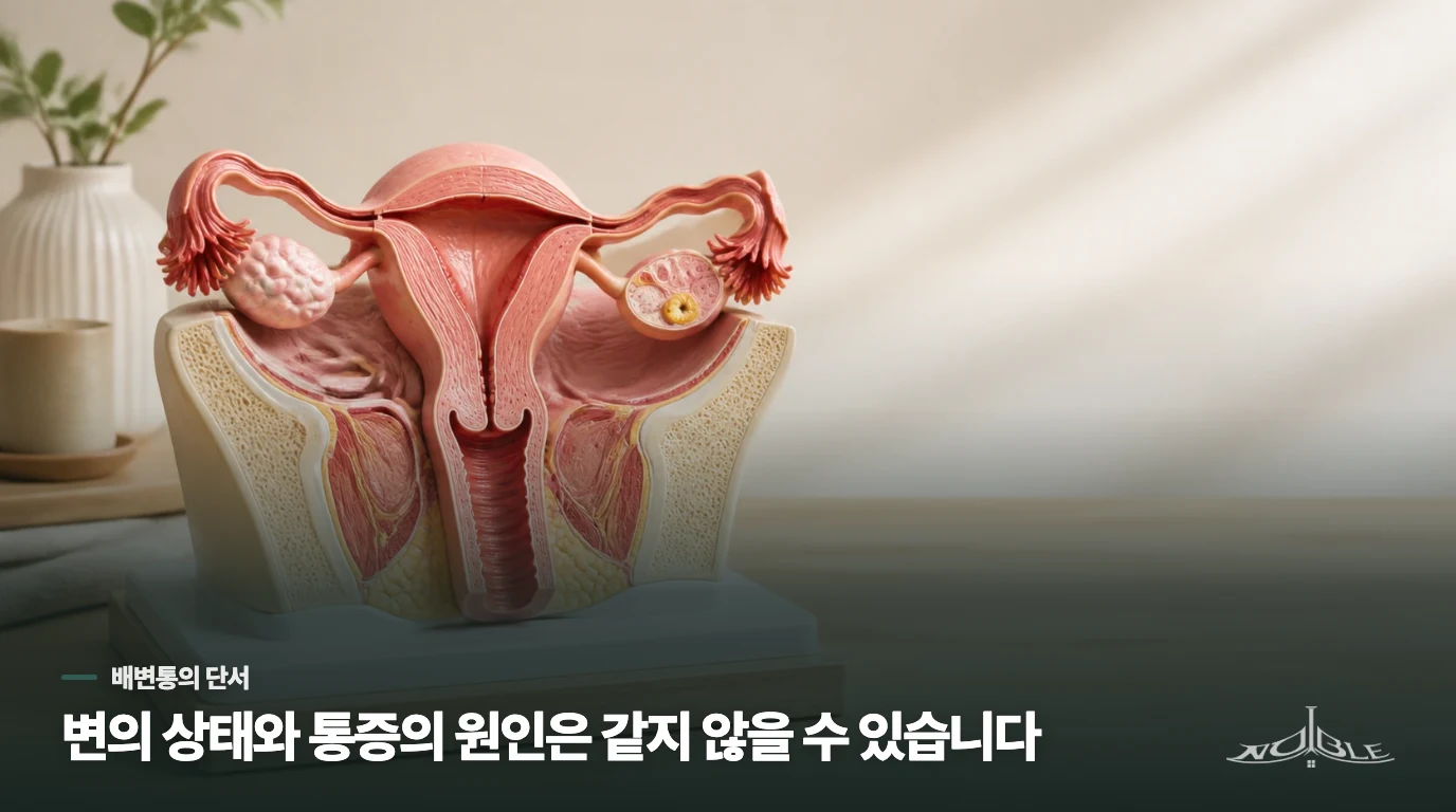 변이 부드러운데도 배변할 때 아픈 이유