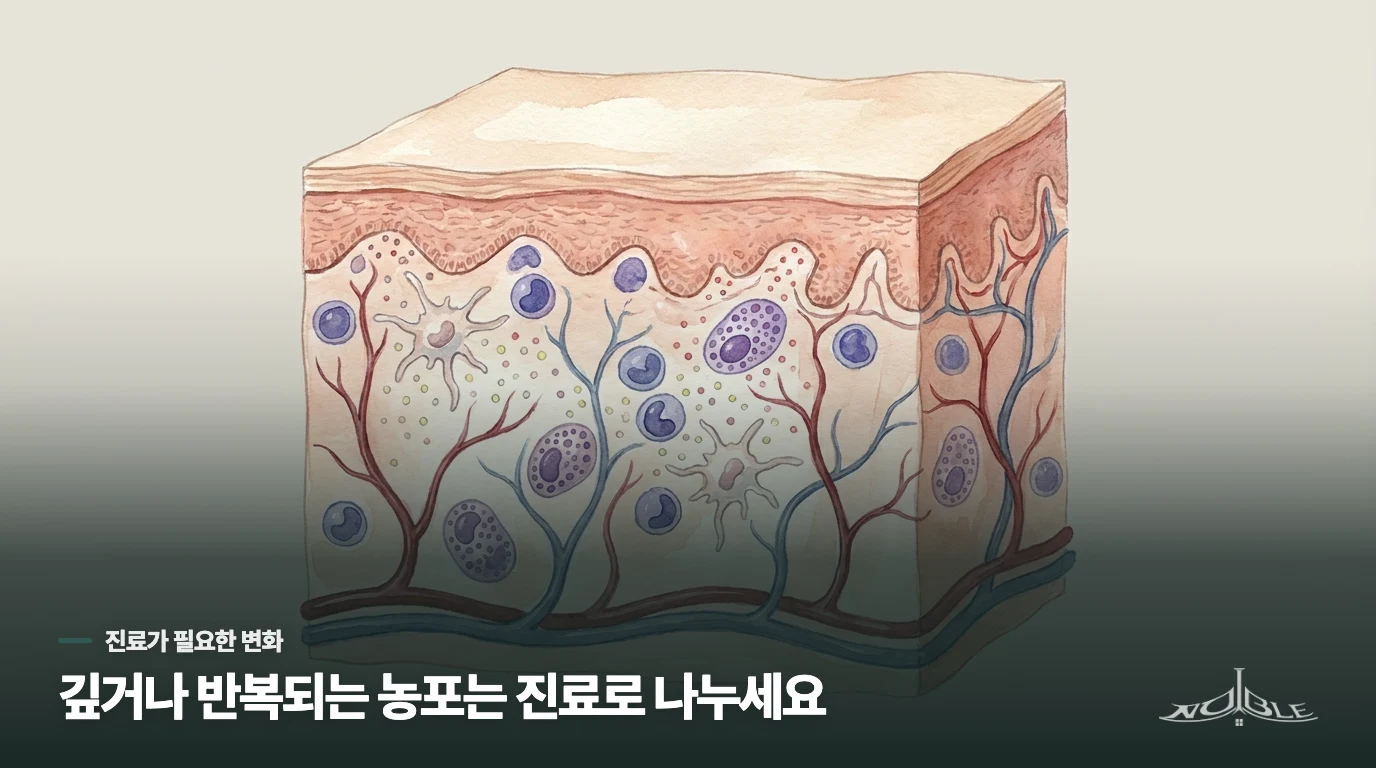 깊은 병변이나 반복되는 농포는 진료에서 원인을 나눠야 합니다