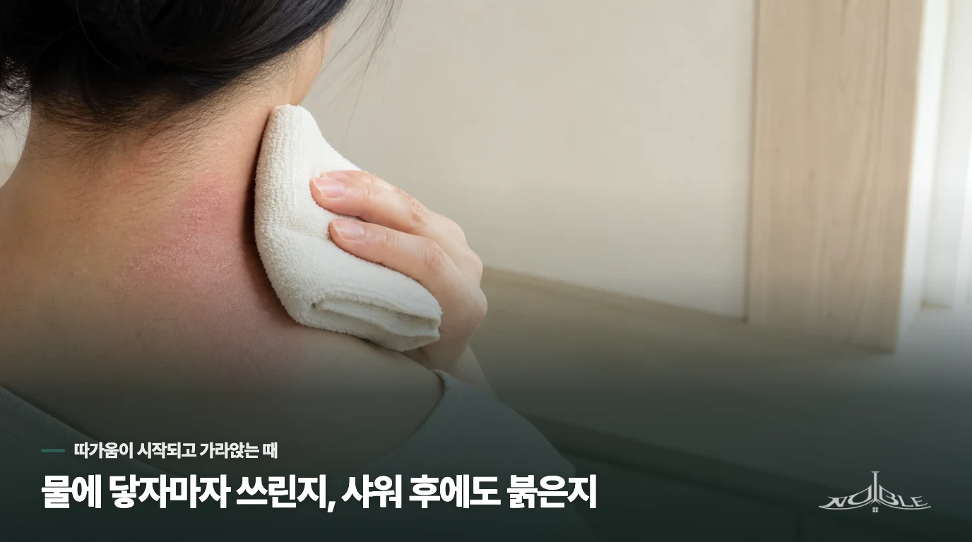 물에 닿자마자 쓰린지, 샤워 후에도 붉은지
