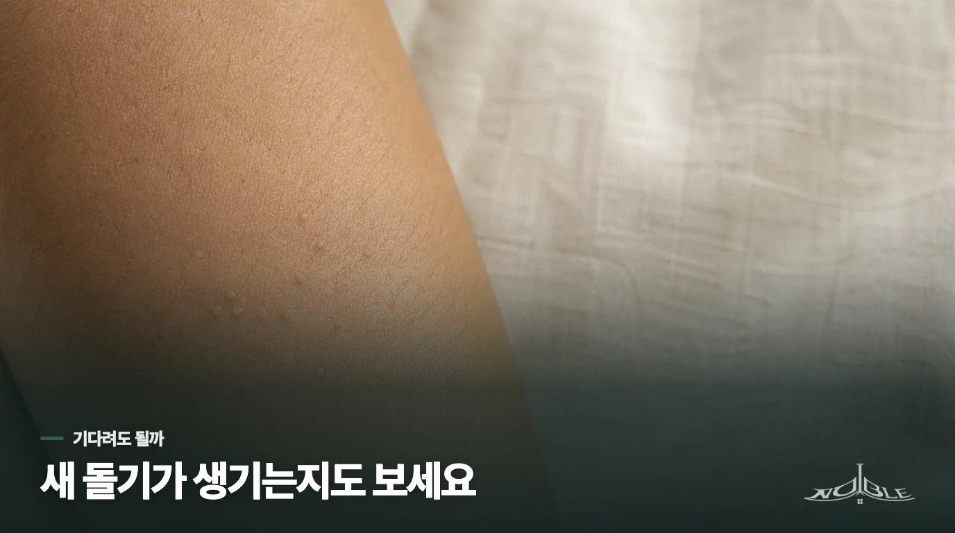 작은 돌기 몇 개가 그대로라면 기다려도 될까요?
