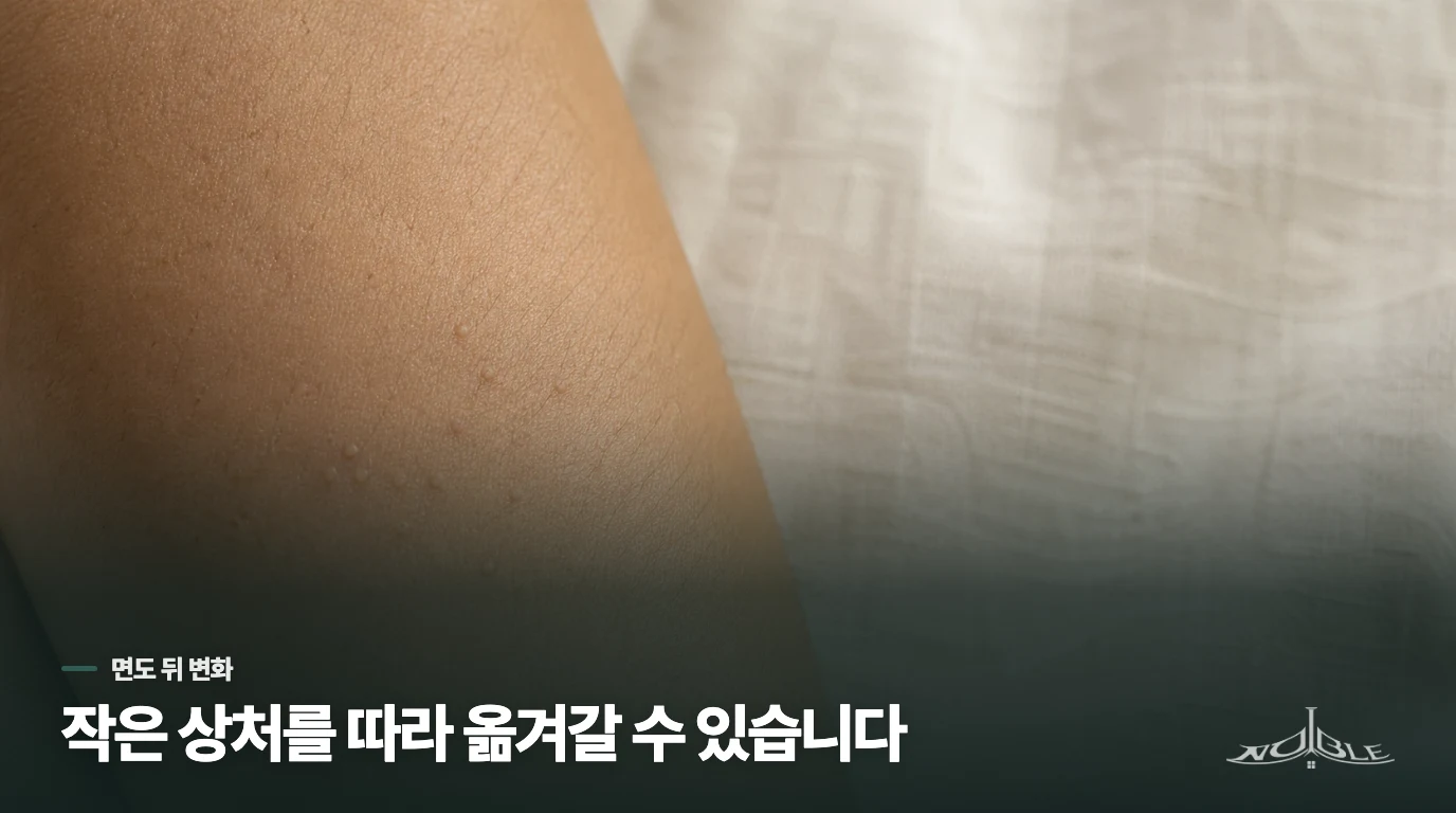 면도날이 지나간 자리를 따라 늘어나는 까닭