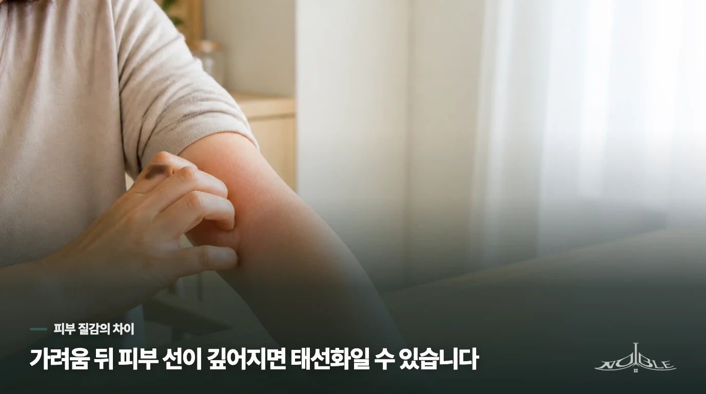 하얀 각질과 가죽처럼 두꺼워진 피부는 어떻게 다를까요?