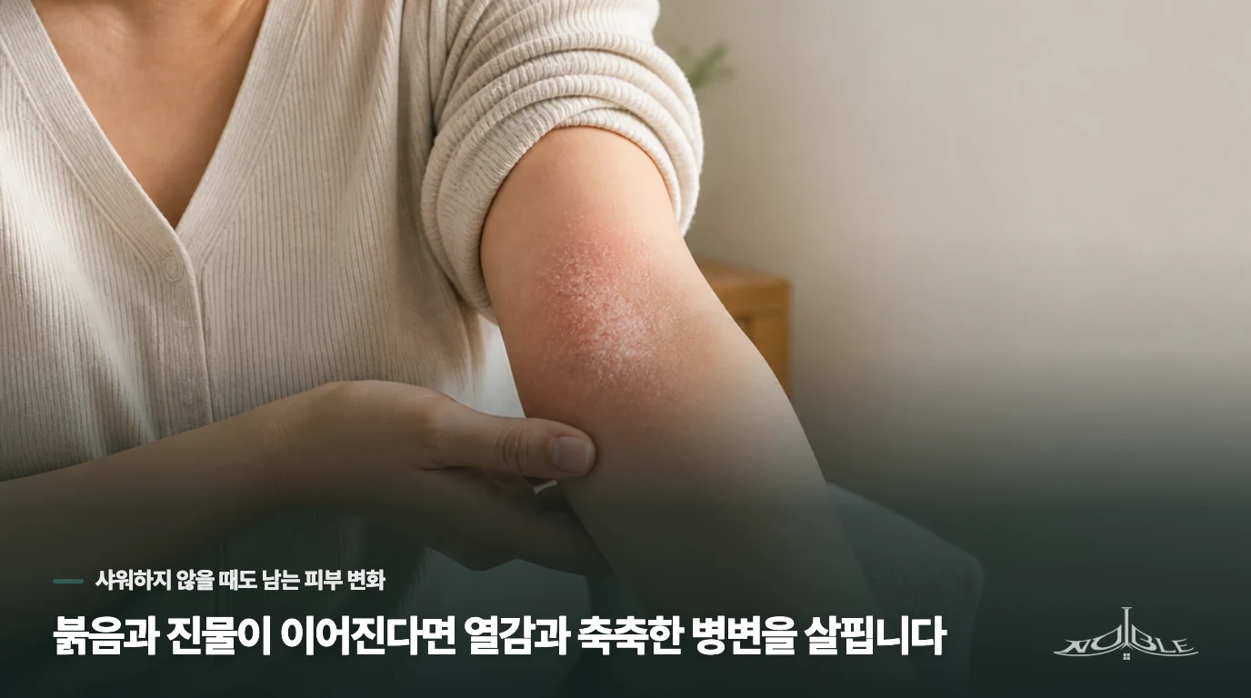 붉음과 진물이 이어진다면 열감과 축축한 병변을 살핍니다