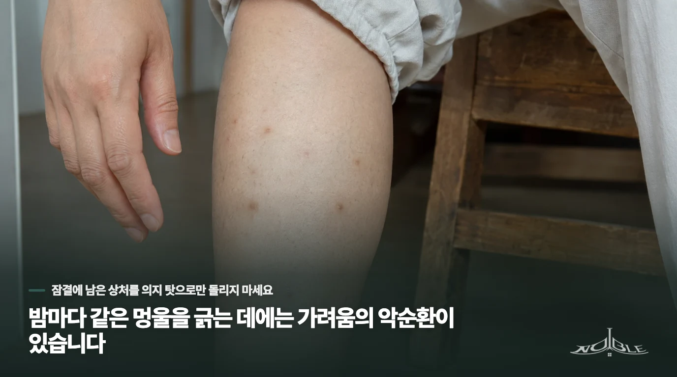 밤마다 같은 멍울을 긁는 데에는 가려움의 악순환이 있습니다