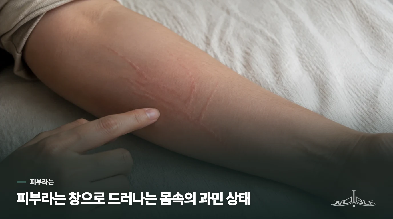피부라는 창으로 드러나는 몸속의 과민 상태