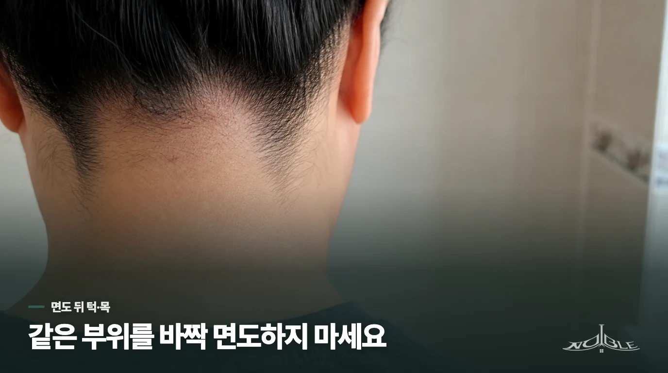 면도 뒤 턱과 목에 반복되는 이유