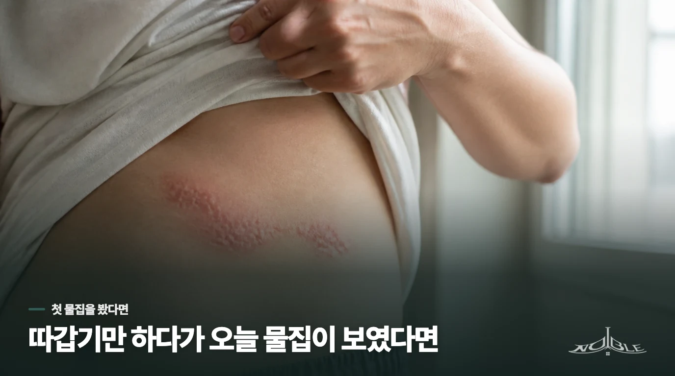 따갑기만 하다가 오늘 물집이 보였다면