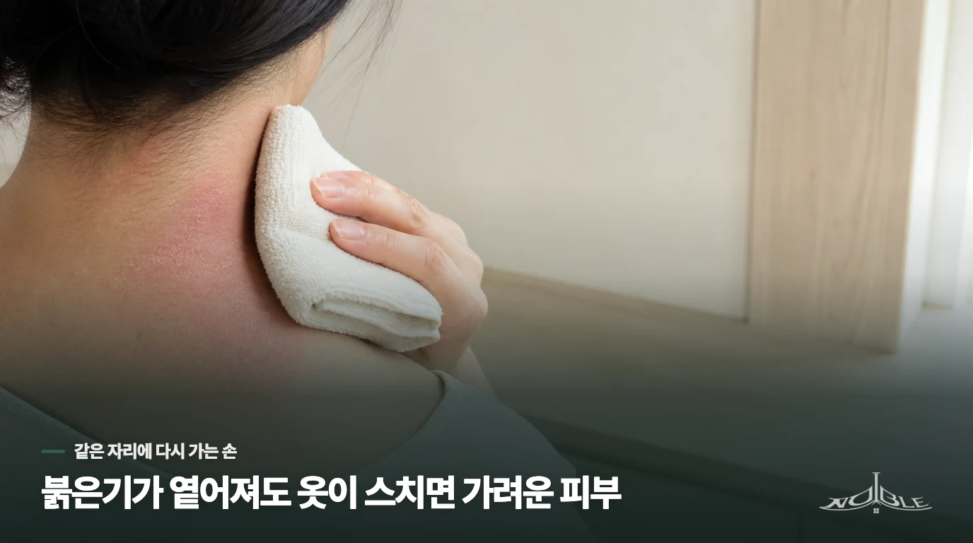 붉은기가 옅어져도 옷이 스치면 가려운 피부