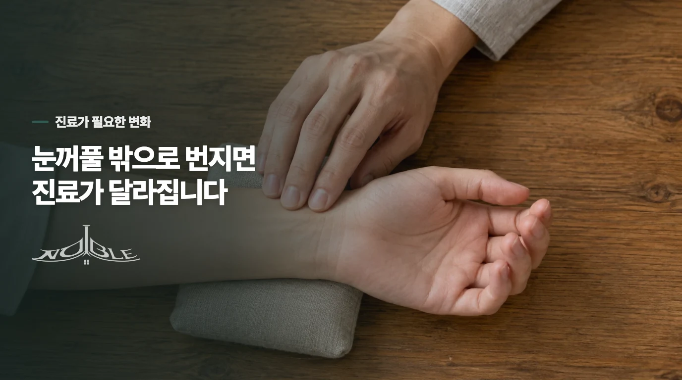 눈이 감기거나 얼굴로 번지면 평가가 달라집니다