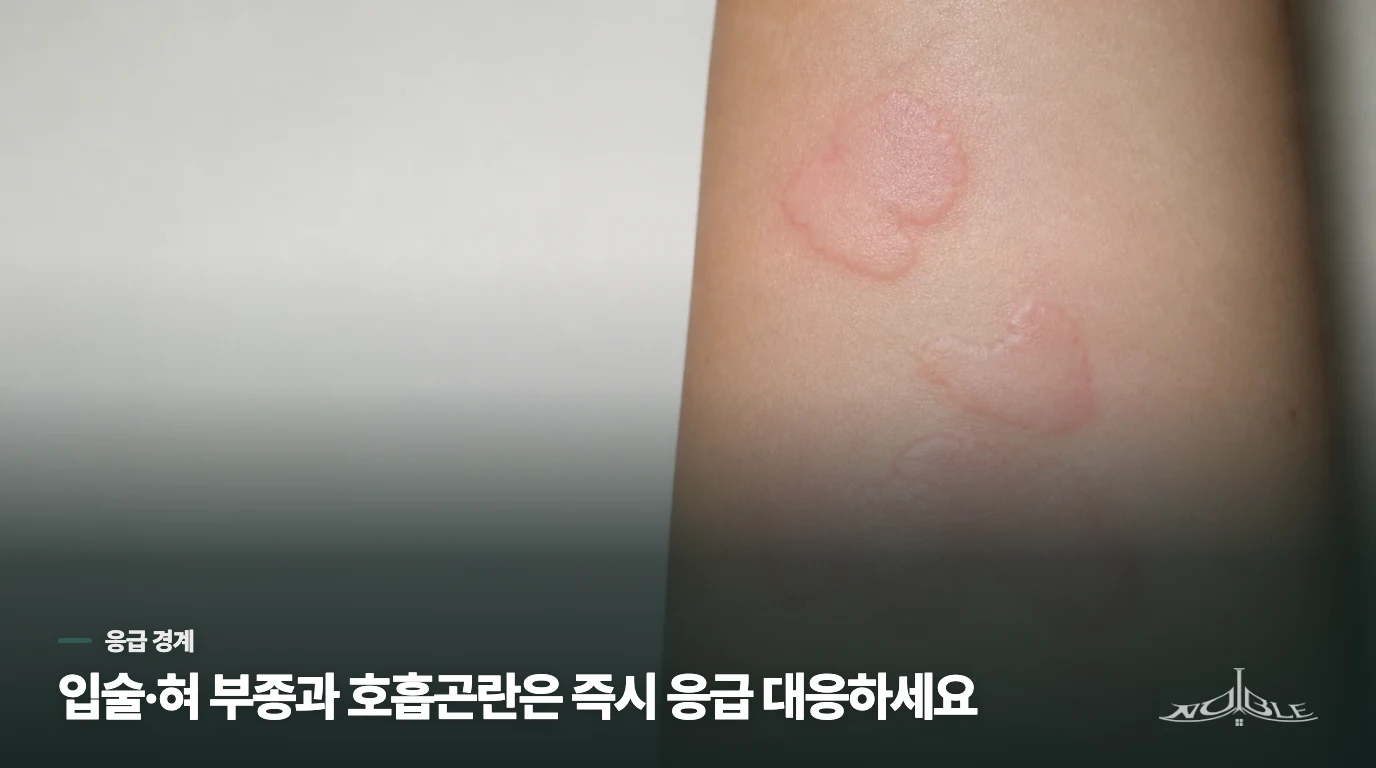 입술·혀가 붓거나 숨이 차면 피부 진료보다 응급 대응이 먼저입니다