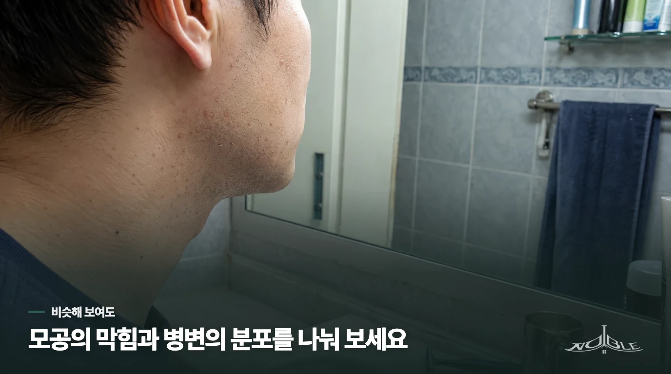 좁쌀여드름은 모공 속 면포, 편평사마귀는 바이러스성 피부 병변입니다